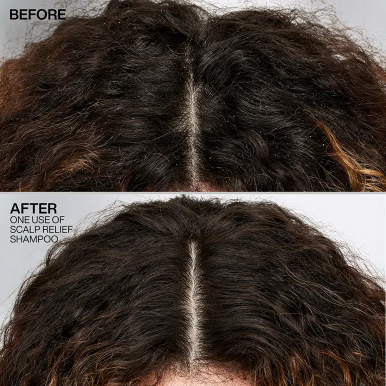 Redken Scalp Relief Dandruff Shampoo 250ml